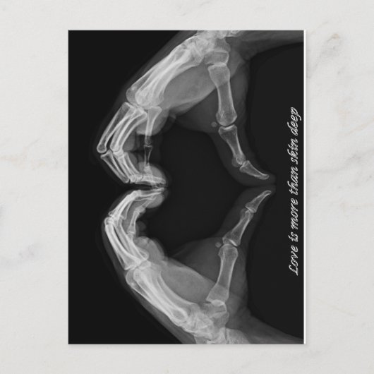 X線アート ポストカード (正面)