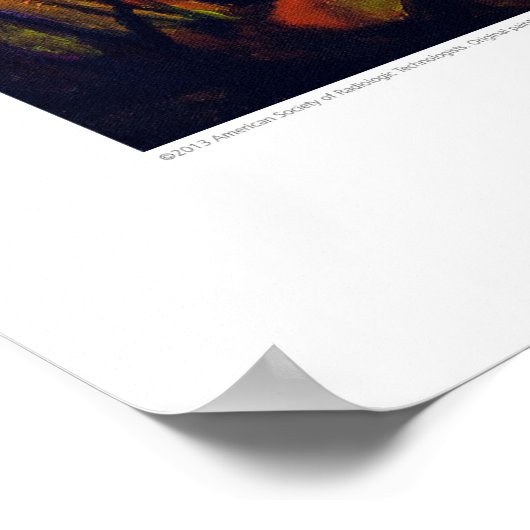 X線カバーアート – 中手骨樺の木by L. Rainey ポスター (角)