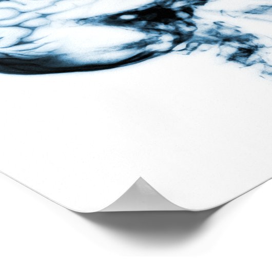 X線スカル脳 – 青 ポスター (角)