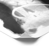 X線スケルトンハンズ&ジュエリー- B&W ポスター (角)