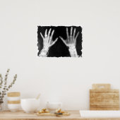 X線スケルトンハンズ&ジュエリー- B&W ポスター (キッチン)