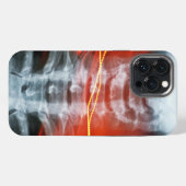 X線デジタルアートフォンケース iPhoneケース (裏面横)