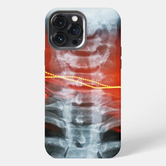 X線デジタルアートフォンケース iPhoneケース (裏面)