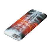 X線デジタルアートワーク電話ケース Case-Mate iPhoneケース (底)