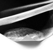 X線ビジョンスケルトンスカル- B&W ポスター (角)