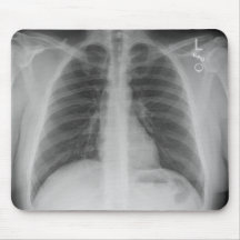 X線マウスパッド