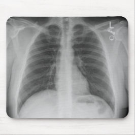 X線マウスパッド マウスパッド