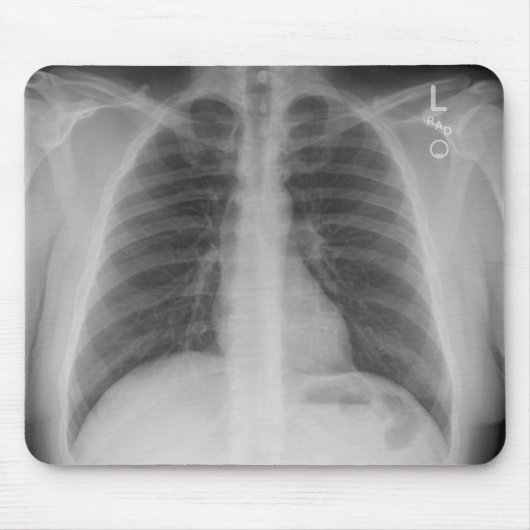 X線マウスパッド マウスパッド (正面)