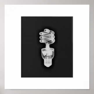 x線写真 ポスター