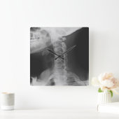 X線撮影をされた2 スクエア壁時計 (ホーム)