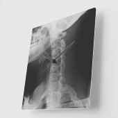 X線撮影をされた2 スクエア壁時計 (傾斜)