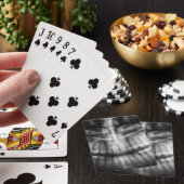 X線歯口スマイル白黒 トランプ (インサイチュ)