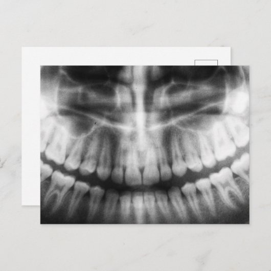 X線歯口スマイル白黒 ポストカード (正面/裏面)