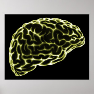 X線脳側視黄色 ポスター