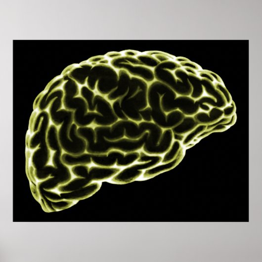 X線脳側視黄色 ポスター (正面)