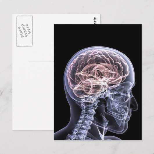 X線脳 ポストカード (正面/裏面)