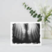 X線足ヒト骨格ボーンブラック&ホワイト ポストカード (スタンド正面)