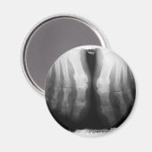 X線足ヒト骨格ボーンブラック&ホワイト マグネット (正面/裏面)