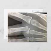 x線骨折の骨はすぐに治る ポストカード (正面/裏面)