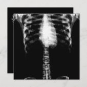 X線骨格トルソリブ – B&W 招待状 (正面/裏面)