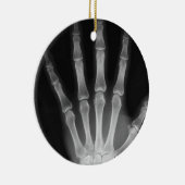 X線骨組手指B&W セラミックオーナメント (右)