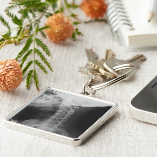 X線2 キーホルダー (側面)