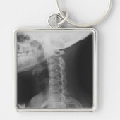 X線2 キーホルダー (正面)