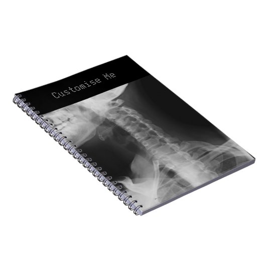 X線2 ノートブック (右側)