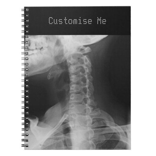 X線2 ノートブック (正面)