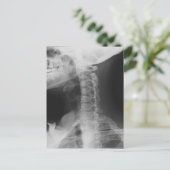 X線2 ポストカード (スタンド正面)