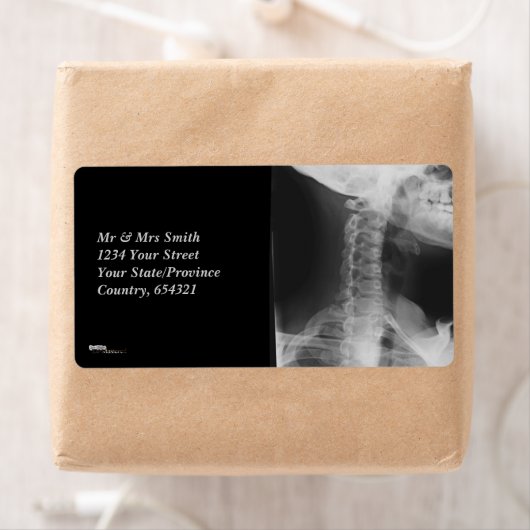 X線2 ラベル (インサイチュ)