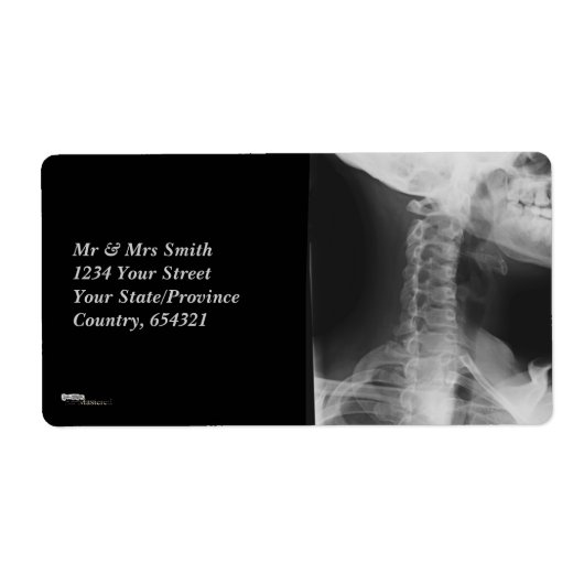 X線2 ラベル (正面)