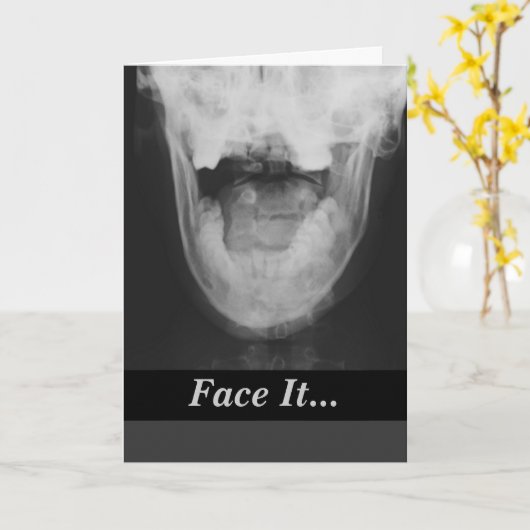 X線3 カード (黄色い花)