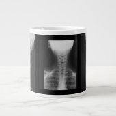 X線3 ジャンボコーヒーマグカップ (正面)