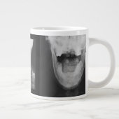 X線3 ジャンボコーヒーマグカップ (右)