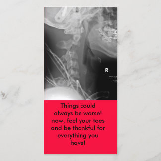 X線、事はより悪い常にことができます! 今、感じy… サンキューカード