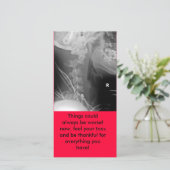 X線、事はより悪い常にことができます! 今、感じy… サンキューカード (スタンド正面)