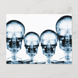 X-Ray Vision Skeleton Skull - Blue ポストカード