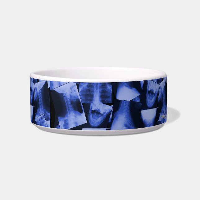 X-rayed – 電磁ブルー ボウル (右)