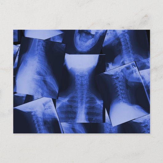 X-rayed – 電磁ブルー ポストカード (正面)