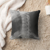 X-Rayed 2 (オリジナル) クッション (ブランケット)