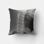 X-Rayed 2 (オリジナル) クッション (裏面)