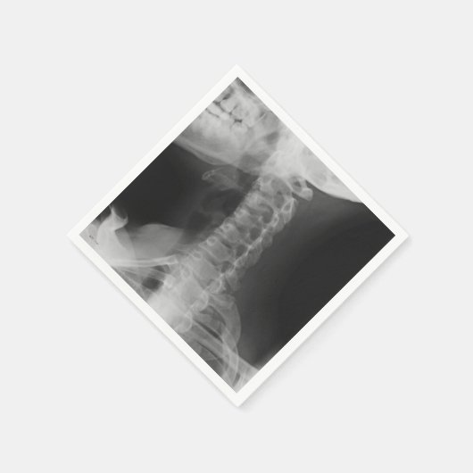 X-Rayed 2 (オリジナル) スタンダードカクテルナプキン (角)