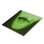 X-rayed 3 – 放射性グリーン タイル (側面)