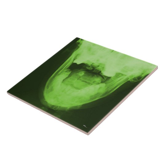 X-rayed 3 – 放射性グリーン タイル (側面)