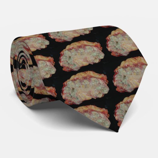 Xanthogranulomatousの腎盂腎炎 ネクタイ (ロール)